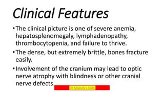 191019 osteopetrosis | PPT