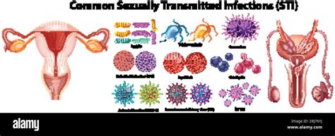 Illustrated Infographic Highlighting Common Sexually Transmitted