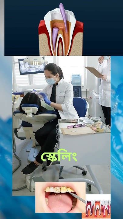 Smart Dental Care Youtube