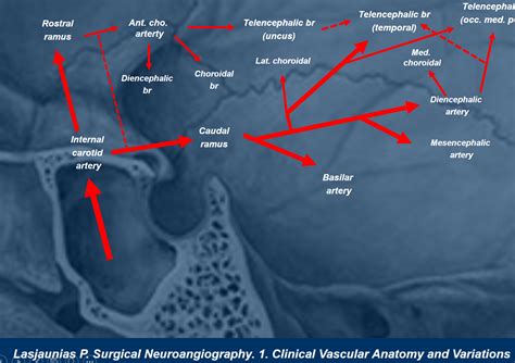 Anterior Choroidal Artery | neuroangio.org