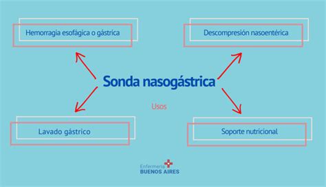 Mapa mental de sonda nasogástrica 2024