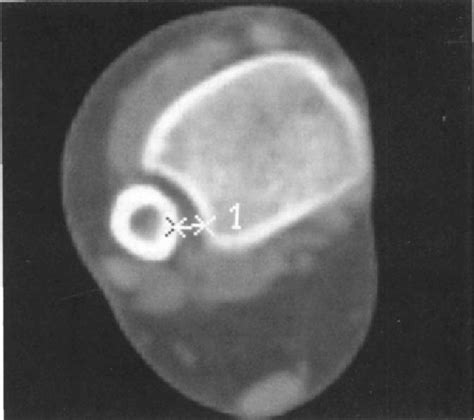 Figure 3 From An Anatomic And Radiographic Investigation Of The