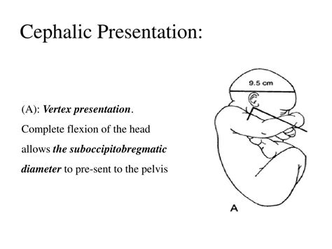 Ppt Chapter 22 Processes And Stages Of Labor And Birth Powerpoint Presentation Id 6051093