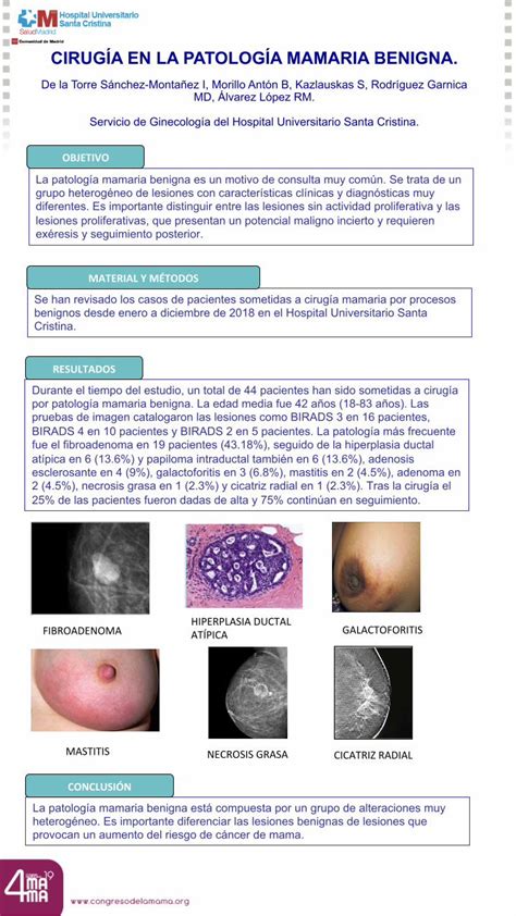 PDF CIRUGÍA EN LA PATOLOGÍA MAMARIA BENIGNA La patología mamaria