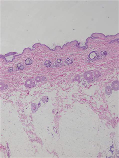 Hypodermis Histology