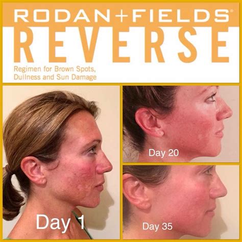 Rodan Fields Reverse Regimen Rodan Fields Skin Care Rodan And