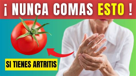 Artritis Los 10 Alimentos Prohibidos Que Debes Evitar Youtube