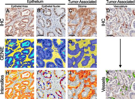 Image Analysis Workflow For Immunohistochemical Staining Download