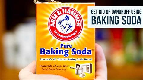 How To Get Rid Of Dandruff Using Baking Soda