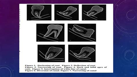 Radiographic Assessment Of Impacted Teeth Pptx