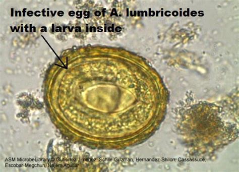 An Infective Egg Of Ascaris Lumbricoides With A Larva Labeled View