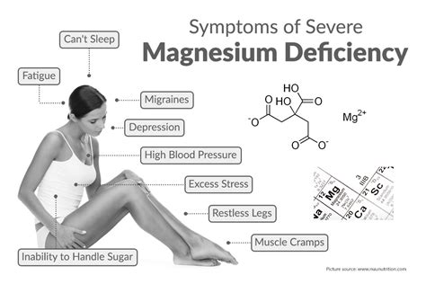 Magnesium Deficiency. Some Facts about Magnesium