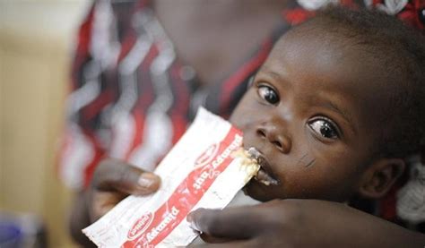 Ogni Anno 3 1 Milioni Di Bambini Muoiono Per Denutrizione