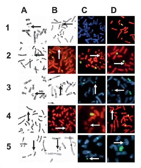 A A Gtg Banded Partial Metaphases From Cases Showing The Min Smc