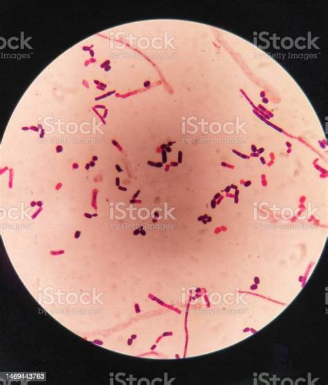 Yeast Cells And Hyphae In Gram Stain Fine With Microscope Stock Photo - Download Image Now - iStock