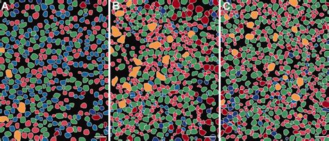 Opsin Immunoreactivity A B Rod Opsin In A Control And B 12 Week