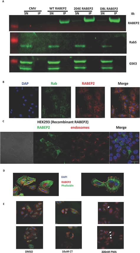 RABEP2 Does Not Associate With Rab5 Early Endosomes Or Macropinosomes