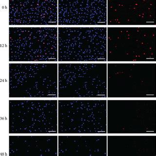 Compression Decreased Cell Viability And Induced Apoptosis In Human