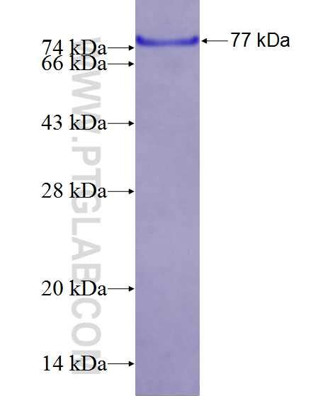 Mdm Fusion Protein Ag Proteintech