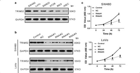 Knockdown Of Trim52 Suppresses Cell Proliferation Of Crc Cells A Download Scientific Diagram