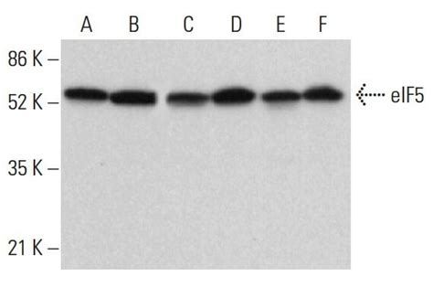 EIF5 Antibody E 10 SCBT Santa Cruz Biotechnology