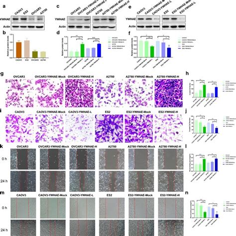 Ywhae Affects Cell Invasion Migration And Epithelial Mesenchymal