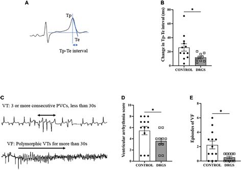 Frontiers Thoracic Dorsal Root Ganglion Stimulation Reduces Acute Myocardial Ischemia Induced