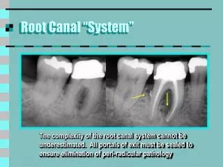 root canal system powerpoint    id