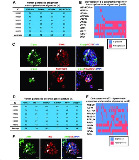 Evidence Of A High Proportion Of Pancreatic Progenitor Transcription