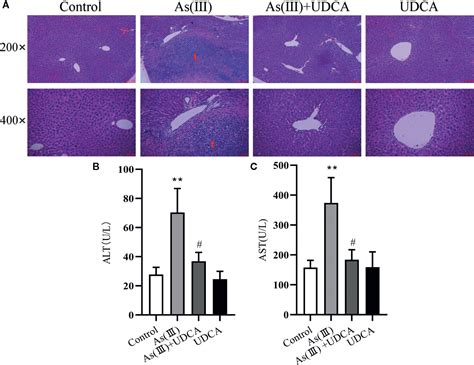 Frontiers Ursodeoxycholic Acid Protects Against Arsenic Induced