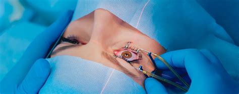 Everything You Should Know About Laser Eye Surgery Voice Cancer