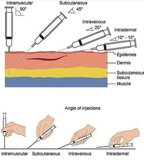 Type Of Injections Medizzy