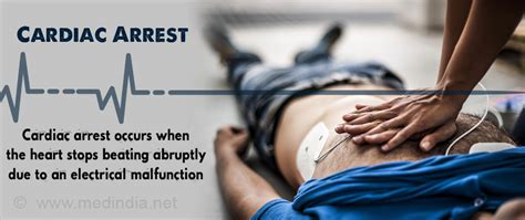 Cardiac Arrest Causes Symptoms Risk Factors Complications