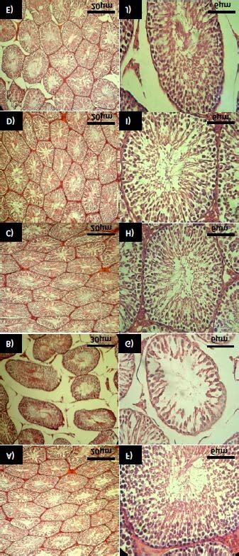 Cross Section From Testis A Control Group Note Normal Testicular