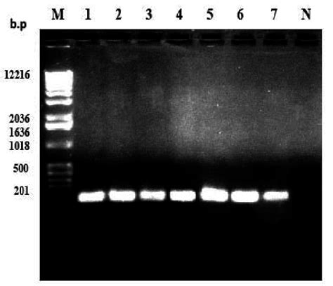 Agarose Gel Electrophoresis Of V6 Region Of 16s Rrna Gene Amplicons