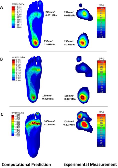 Comparison Of The Plantar Pressure Between Computational Prediction And