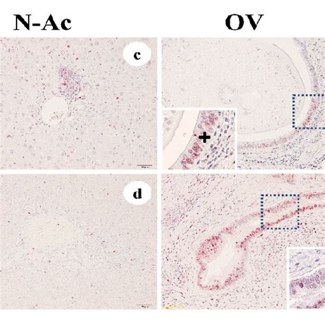 Representative The Expression Of PCNA In The Liver Tissue Of The