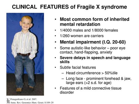 Ppt Fragile X Mental Retardation Protein Fmrp Expression In Zebra