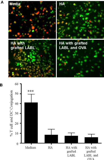 A Cell Colocalization Pictures Showing T Cells Green And Dendritic