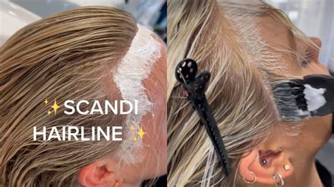 su tiktok  virale il trend scandinavian hairline ma la tecnica