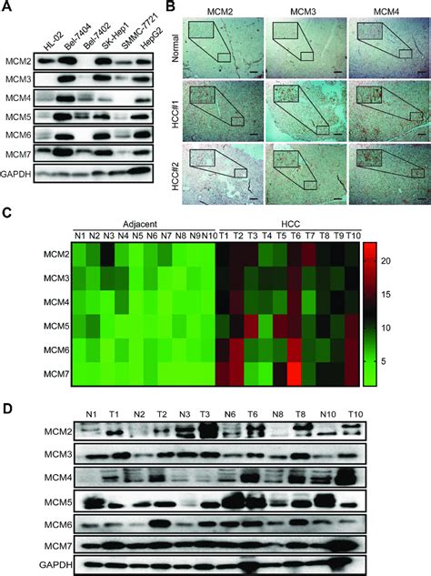 Mcm Proteins Were Up Regulated In Hcc Cell Lines And Tissues A