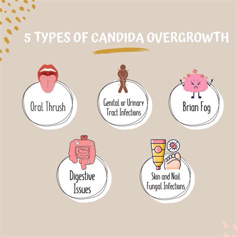 5 Different Types Of Candida Overgrowth Beauty Of Inside Out