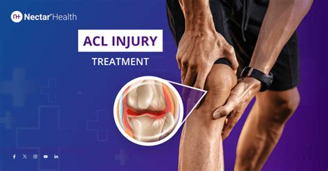 Understanding ACL Injury: Causes, Symptoms, and Treatment - NectarPlus Health Blog