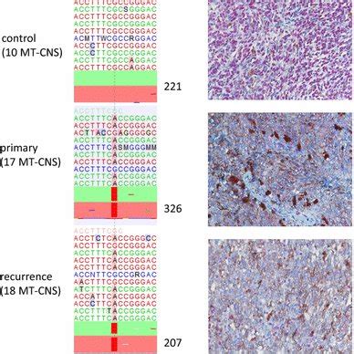 Recurrent GNAQ And GNA11 Mutations In Melanocytic Tumors Of The Central