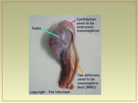 Radical Orchiectomy Anatomy And Physiology