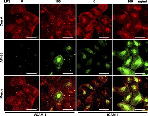 Lps Induced Il Il Vcam And Icam Expression In Human