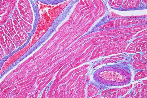 Human Cardiac Muscle Photograph By Choksawatdikorn Science Photo