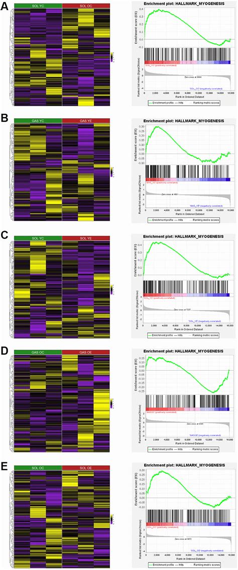 Muscle Fiber Type Dependence Effect Of Exercise On Genomic Networks In