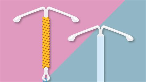 In Depth Guide To The Pros And Cons Of Iuds