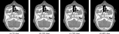 Figure 4 From Self Supervised Projection Denoising For Low Dose Cone